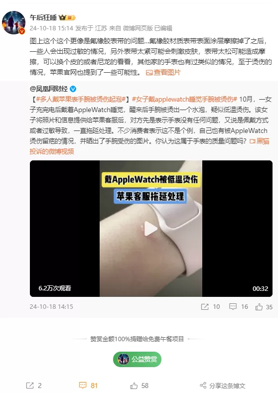 女子戴AppleWatch睡觉被烫伤起泡苹果客服回应:过敏反应